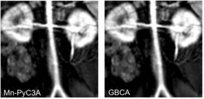 abdominal aorta, renal arteries, and kidneys of a baboon