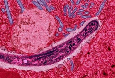 Colorized mircrograph of Plasmodium falciparum