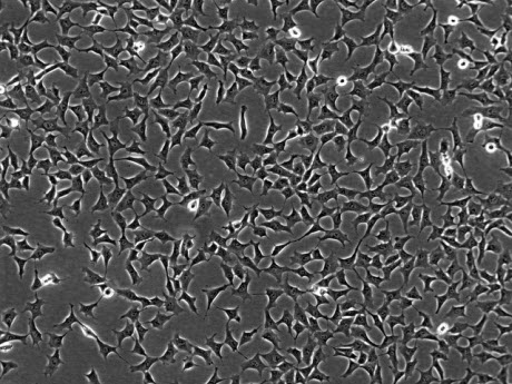 Mesenchymal cells