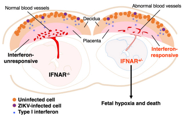 Zika virus in uterus