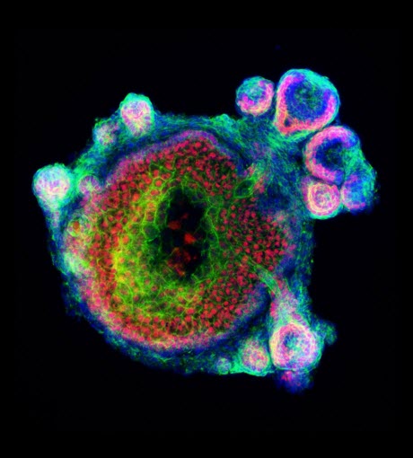 Hair Organoids