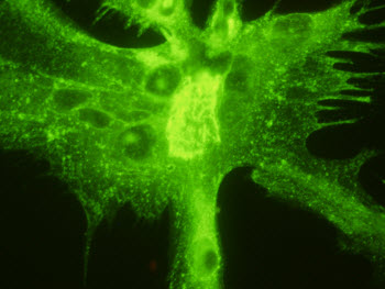 ViroStat has just released new Monoclonal Antibodies to HSV glycoproteins D and G