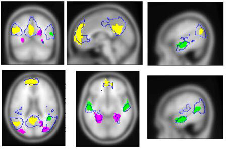 Image depicting the simultaneous activity of three cognitive systems