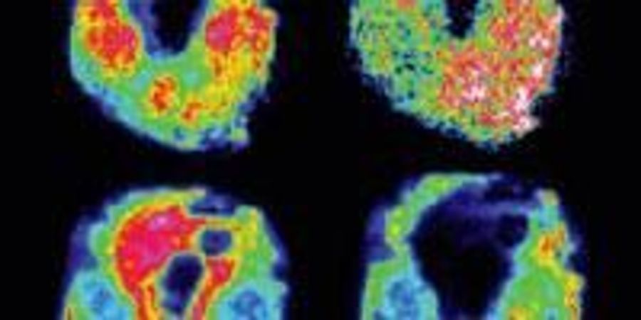 Advances in MALDI Mass Spectrometry within Drug Discovery | Lab Manager