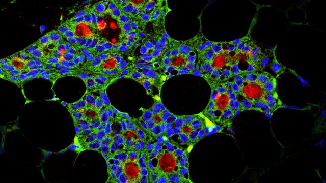 Dental Stem Cells Regenerating Mammary Gland