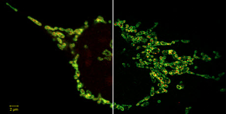 New 2D Superresolution mode for ZEISS Airyscan delivers 120 nanometer lateral resolution