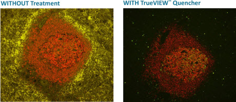 TrueVIEW™ Autofluorescence Quenching Kit