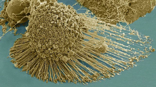 dying cancer cell 