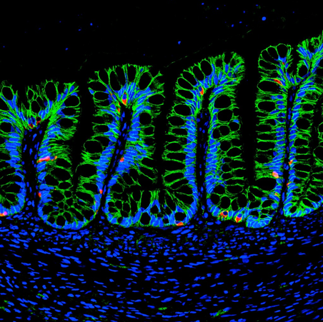 Human intestinal organoids 