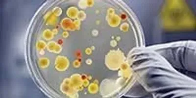 image of a Petri dish with green and yellow groth patterns suggenting the importance of mass pec in clinical microbiology
