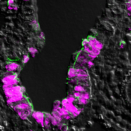 Mouse lung epithelial cells infected with influenza 