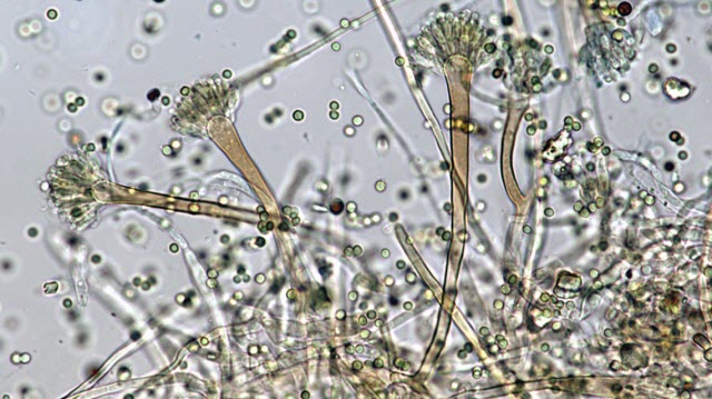 Aspergillus species seen under a microscope