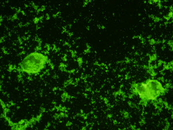 Entamoeba histolytica Monoclonal Antibodies