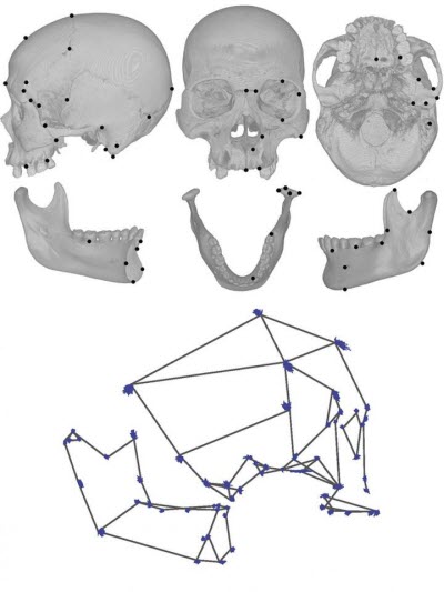 human skull bones