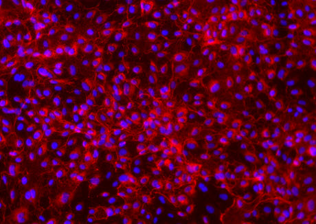 Human umbilical vein endothelial cells