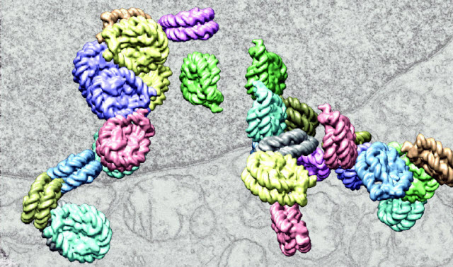 Computer enhanced electron micrograph image of interacting chromatin chains 