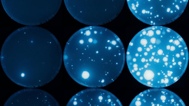 Bacterial colonies with a fluorescent reporter protein appearing on tetracycline plates