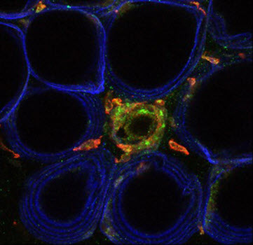 Fat cells outlined in blue 