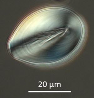 A microscopic starch granules from the Four Corners potato