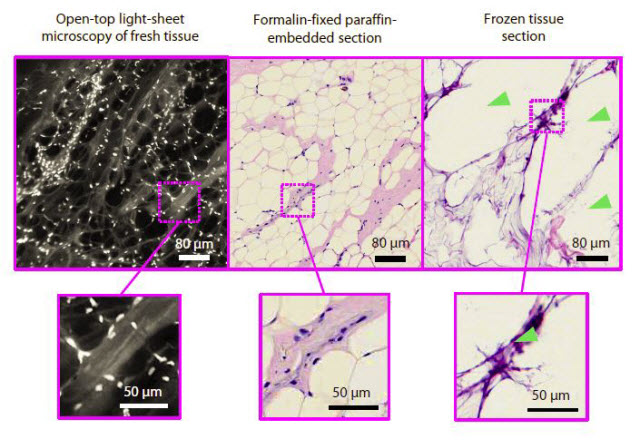 breast tissue comparison