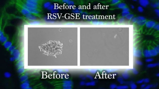 Cancer Stem Cell before and after treatment