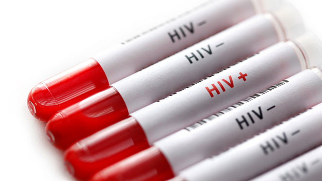 HIV tests