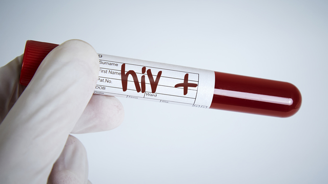 HIV blood sample