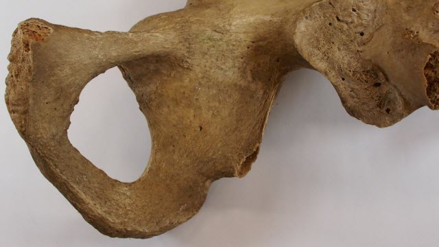 Pelvic Bone