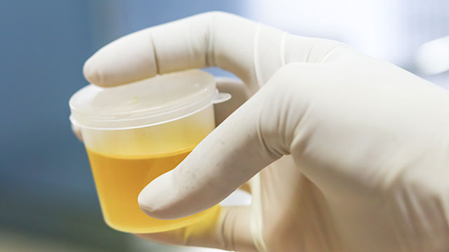 urine sample