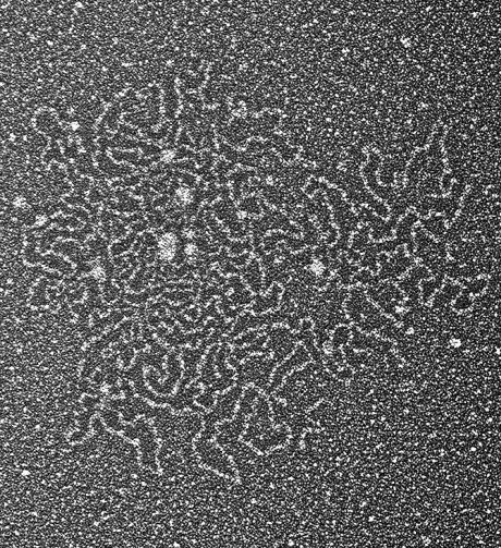Electron microscopy of large, compact mucin protein