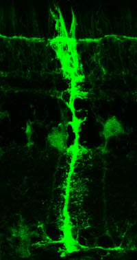 Muller Glia cell in the zebrafish