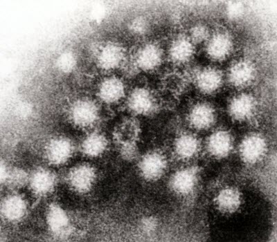 Transmission electron micrograph of norovirus particles in feces