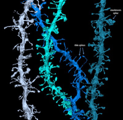 dendrites