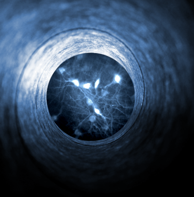 neurotensin cells in the medial preoptic brain area