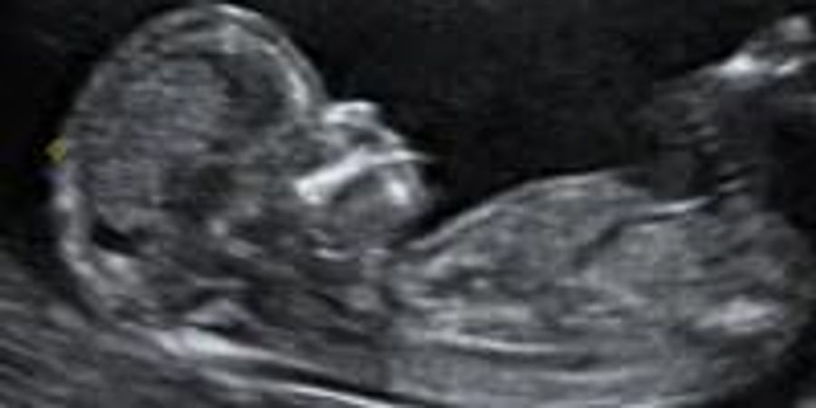 Agilent Technologies Extends Collaboration on Reproductive Genetics ...