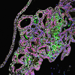 tissue-engineered human stomach tissues