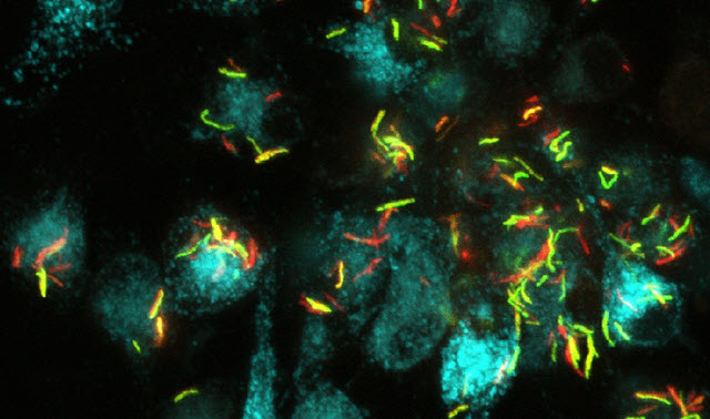 synthetic biosensor 