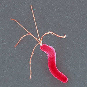 The bacterium Helicobacter pylori