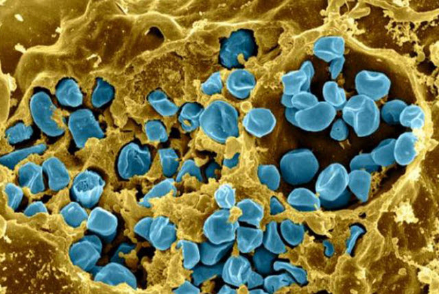 murine macrophage infected with Francisella tularensis strain LVS