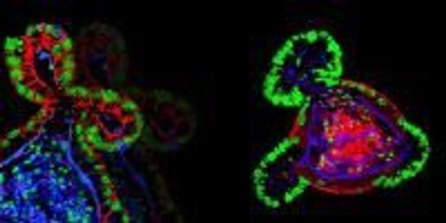 Taking Miniature Organs from Lab to Clinic | Lab Manager