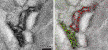 new electron microscope technique