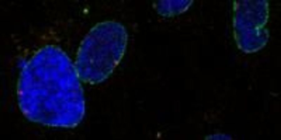 Heart Disease, Leukemia Linked to Dysfunction in Nucleus | Lab Manager