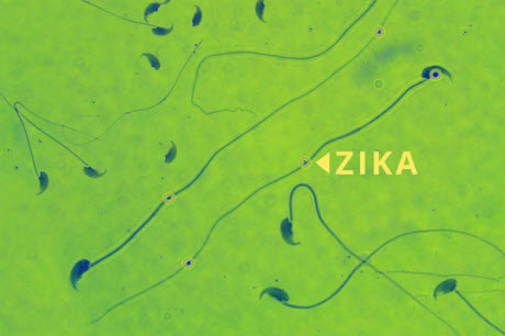 mouse sperm infected with Zika