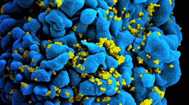 HIV particles infecting a T-cell