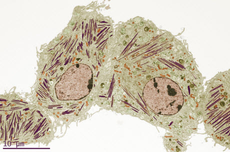 Image of lung cell in mice with Gaucher's disease