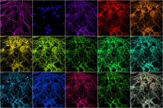 Imaging Synapses