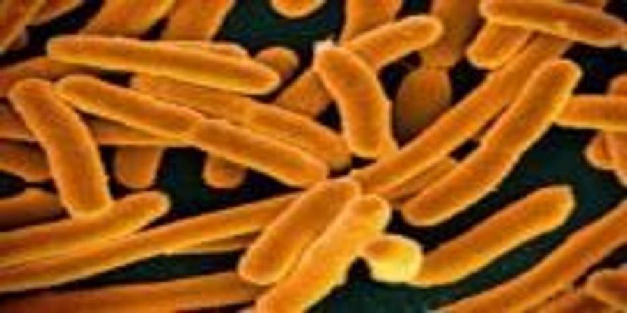 Speedy Bacteria Detector Could Help Prevent Foodborne Illnesses Lab