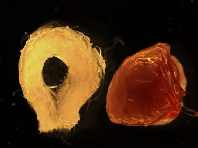liver organoid units 