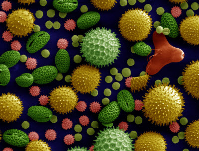 Scanning electron microscope image of pollen grains from a variety of common plants