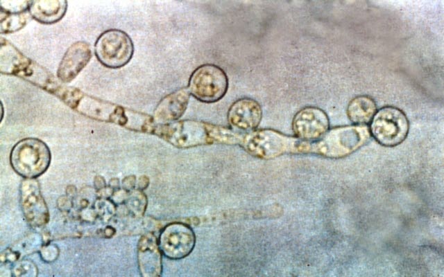 Candida albicans